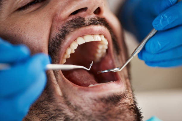 Emergency Dental Services in Richwood, NJ